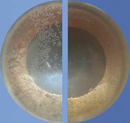 kalkRöhreVorherNachher